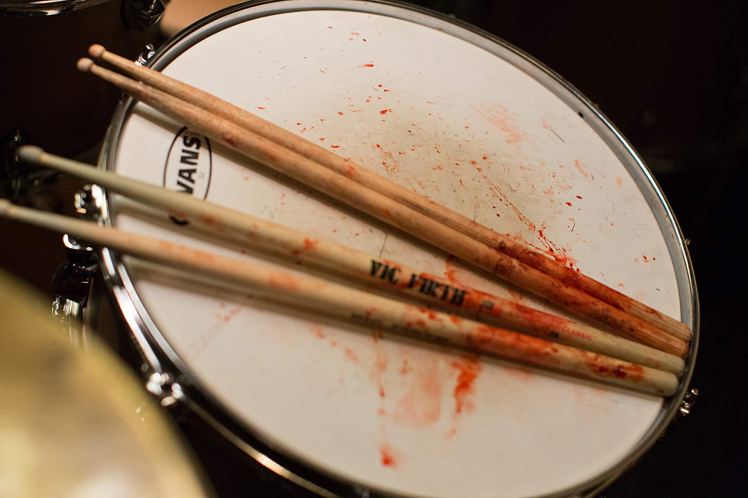 Whiplash 3.jpg